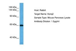 Kv7.2 Rabbit anti-Human, Mouse, Hamster, Polyclonal, Novus Biologicals 0.1 mL | Buy Online | Novus Biologicals | Fisher Scientific